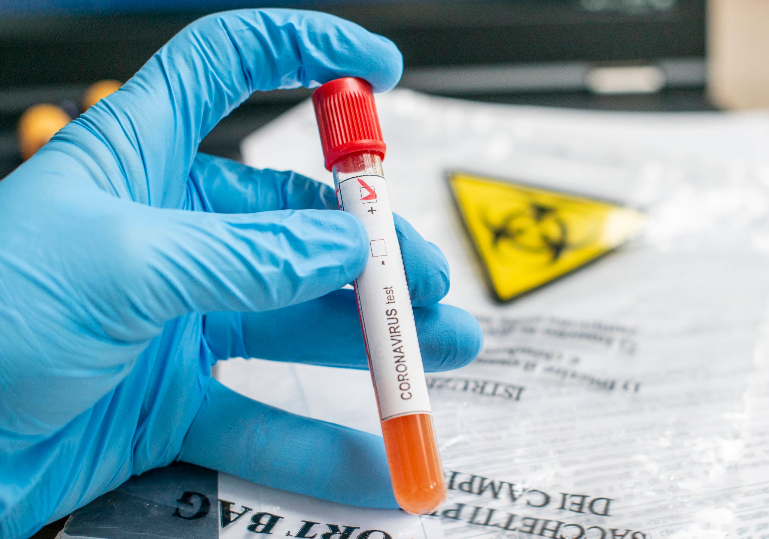 Coronavirus test